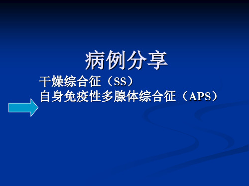 干燥综合征(SS)与自身免疫性多腺体综合征(APS)