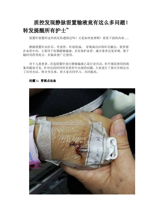 质控发现静脉留置输液竟有这么多问题
