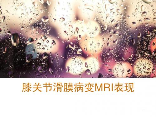 膝关节滑膜病变MRI表现PPT课件