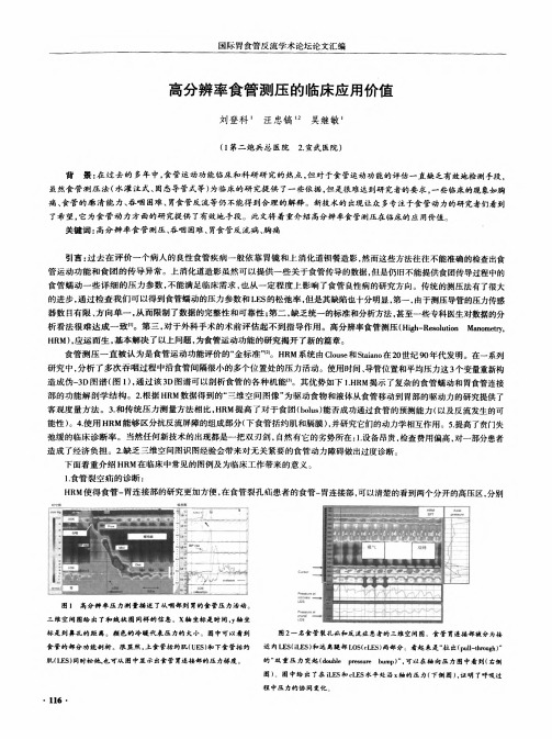 高分辨率食管测压的临床应用价值