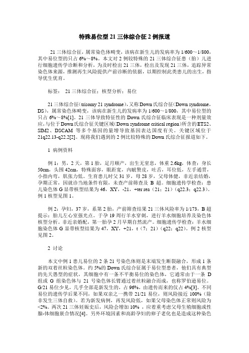 特殊易位型21三体综合征2例报道