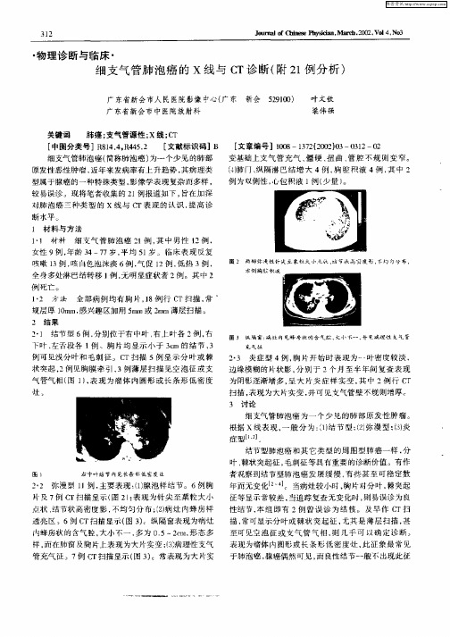 细支气管肺泡癌的X线与CT诊断(附21例分析)