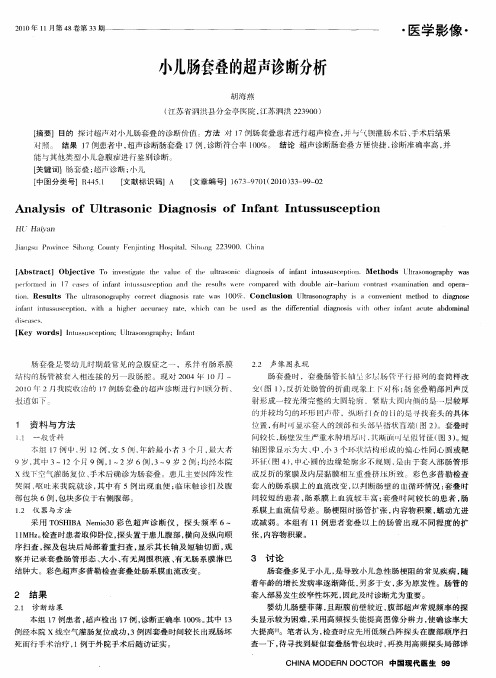 小儿肠套叠的超声诊断分析