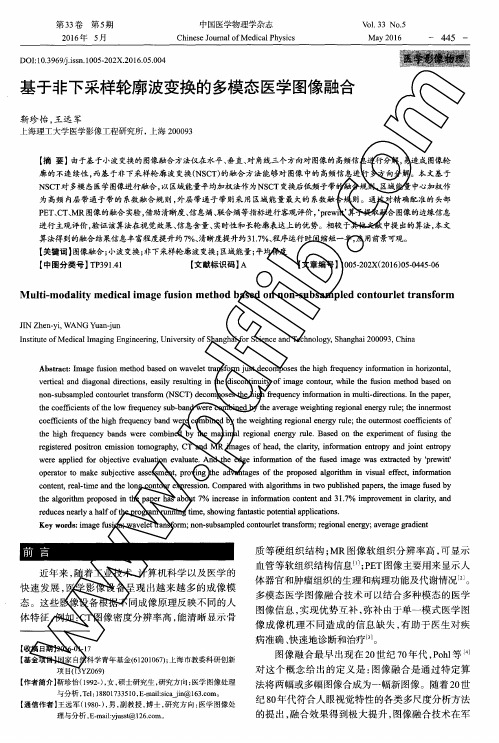基于非下采样轮廓波变换的多模态医学图像融合