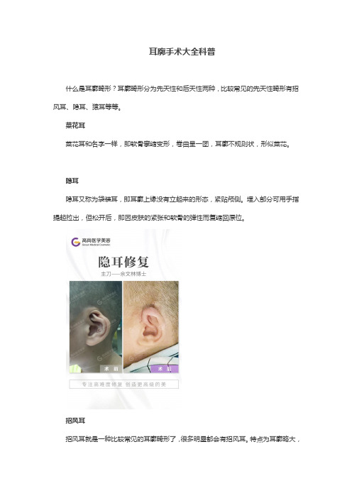 耳廓手术大全科普