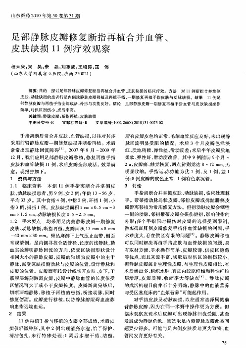 足部静脉皮瓣修复断指再植合并血管、皮肤缺损11例疗效观察
