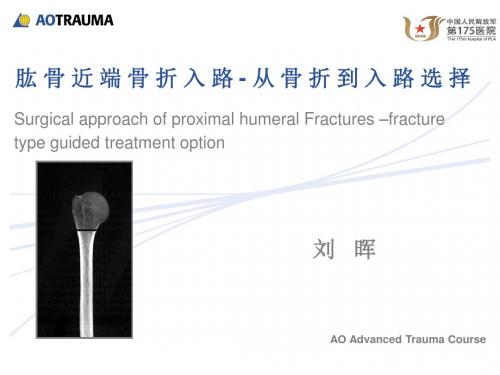 肱骨近端骨折入路-175刘晖