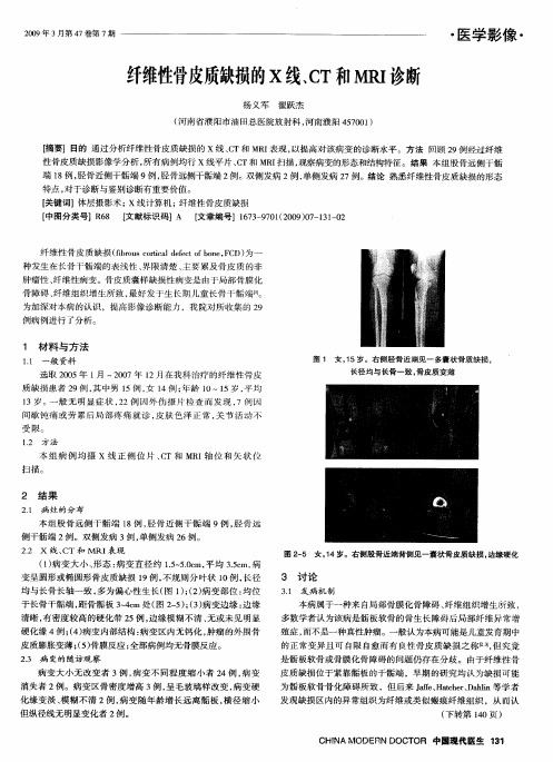 纤维性骨皮质缺损的X线、CT和MRI诊断