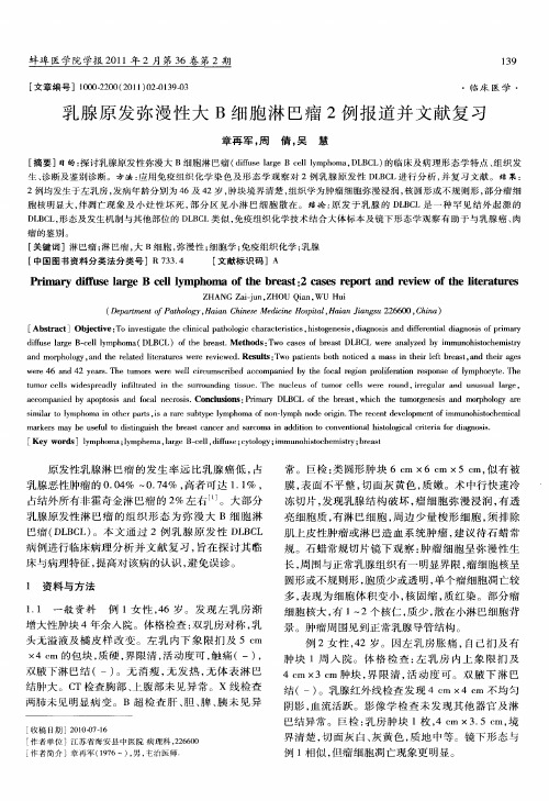 乳腺原发弥漫性大B细胞淋巴瘤2例报道并文献复习
