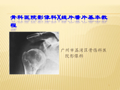 骨科医院影像科X线片看片基本教程PPT课件