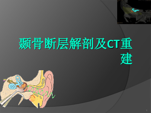 颞骨断层解剖及CT三维重建