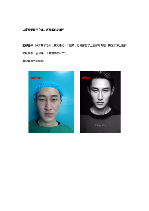 眉弓