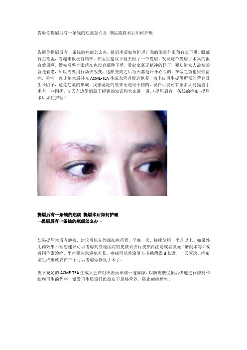 告诉你提眉后有一条线的疤痕怎么办 细品提眉术后如何护理
