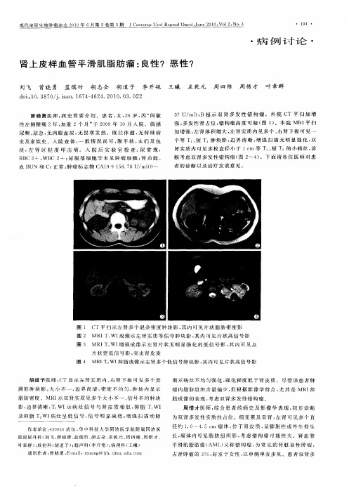 肾上皮样血管平滑肌脂肪瘤：良性？  恶性？