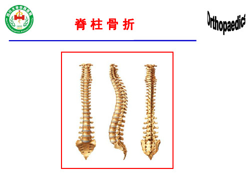 脊柱骨折-精品医学课件