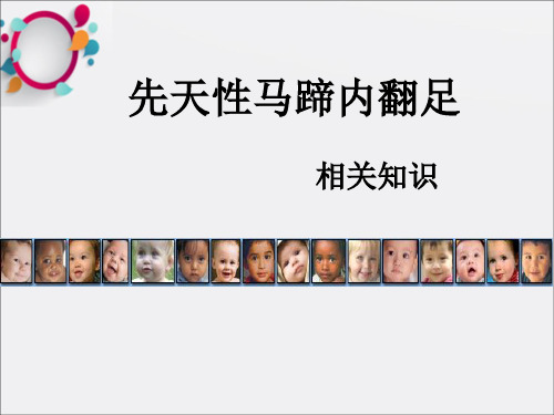 先天性马蹄内翻足相关知识ppt课件