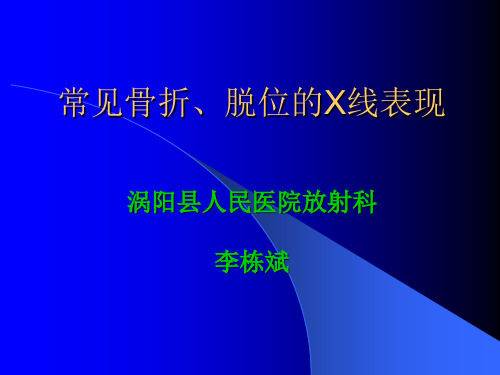 常见骨折、脱位X线表现