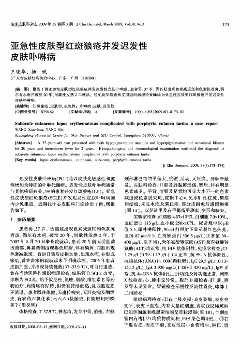 亚急性皮肤型红斑狼疮并发迟发性皮肤卟啉病