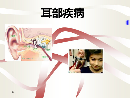 中耳炎PPT课件