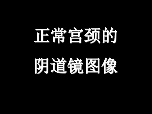 宫颈图PPT课件