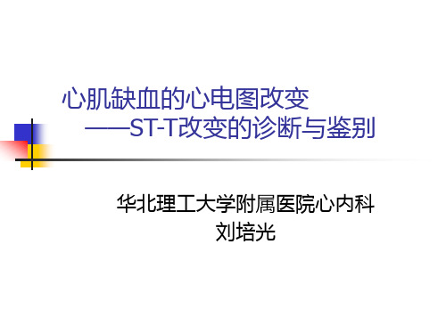 05心肌缺血的心电图改变  —ST-T改变的诊断与鉴别