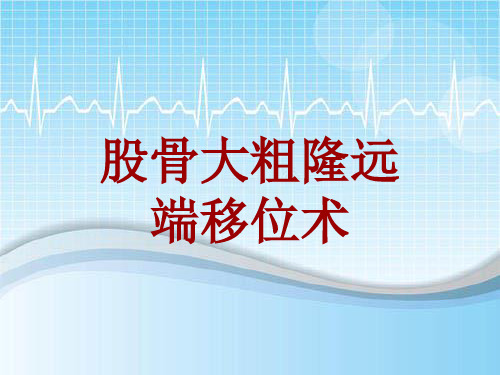 手术讲解模板：股骨大粗隆远端移位术