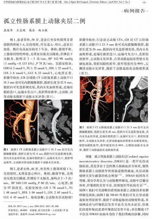 孤立性肠系膜上动脉夹层二例