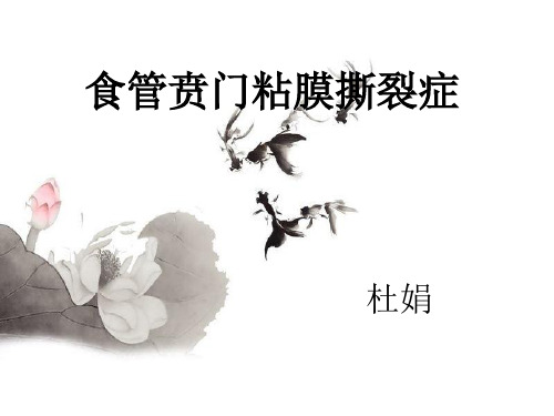 贲门粘膜撕裂护理查房