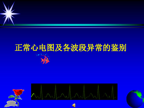正常心电图及各波段异常的鉴别..