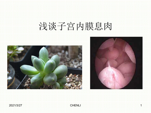 子宫内膜息肉ppt