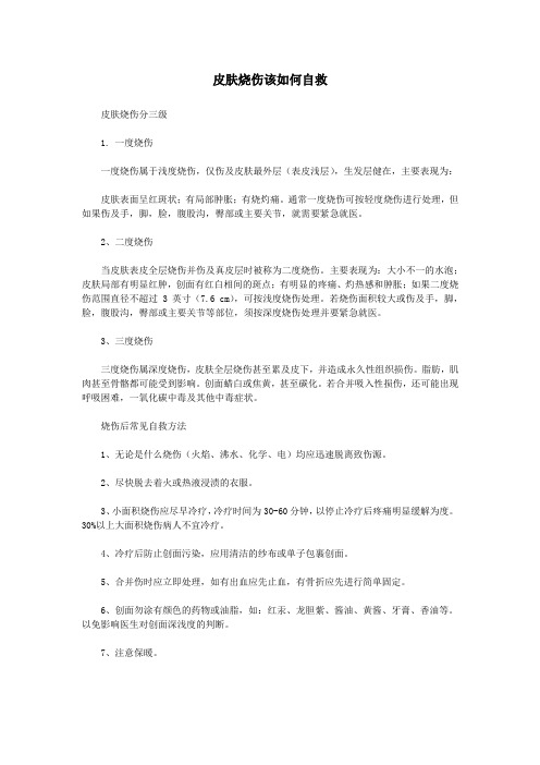 皮肤烧伤该如何自救