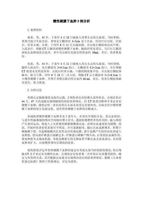 慢性硬膜下血肿2例分析