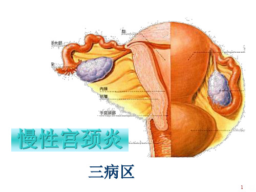 慢性宫颈炎PPT课件