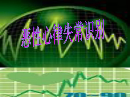 恶性心律失常识别课件