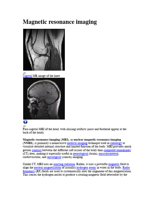 MRI 维基百科