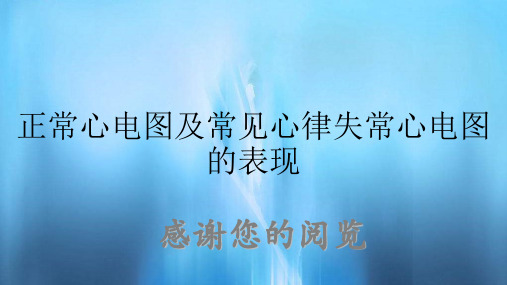 正常心电图及常见心律失常心电图的表现