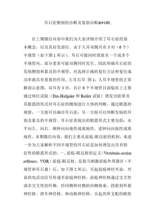 耳石症侧别的诊断及鉴别诊断