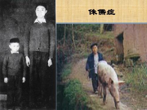 七年级生物下册 5.1《激素调节》课件 新人教版