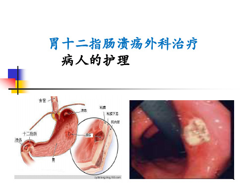 胃十二指肠溃疡外科治疗病人的护理PPT课件