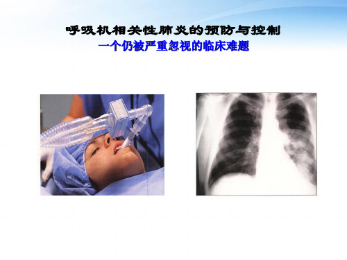 呼吸机相关性肺炎的预防与控制  ppt课件