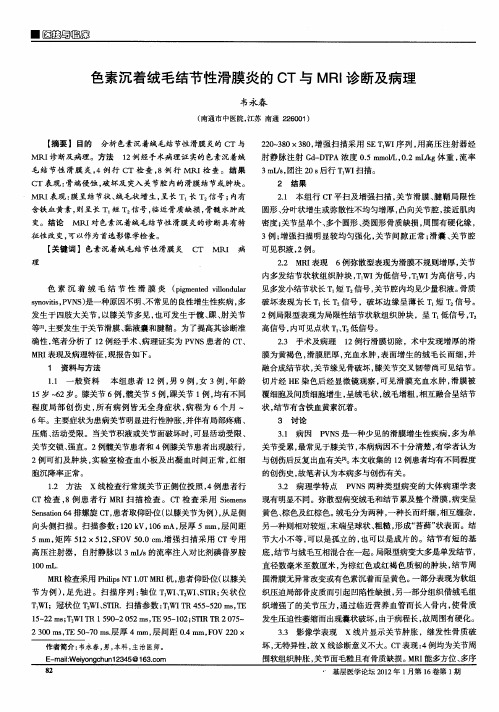色素沉着绒毛结节性滑膜炎的CT与MRI诊断及病理