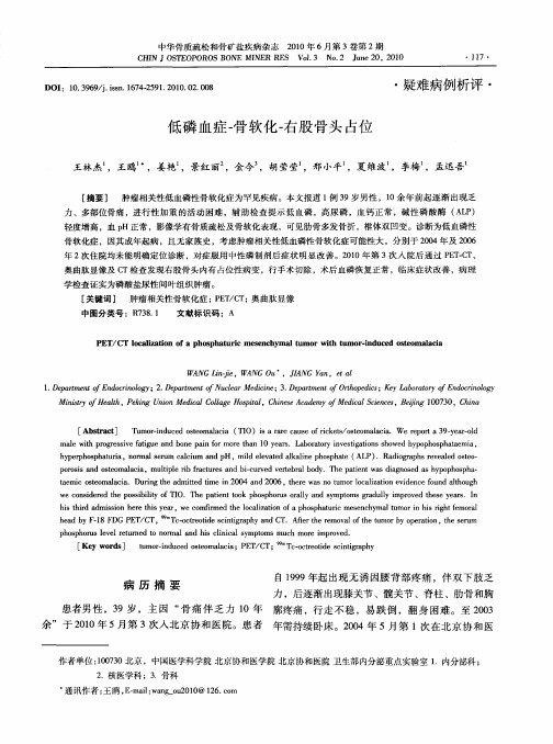 低磷血症-骨软化-右股骨头占位