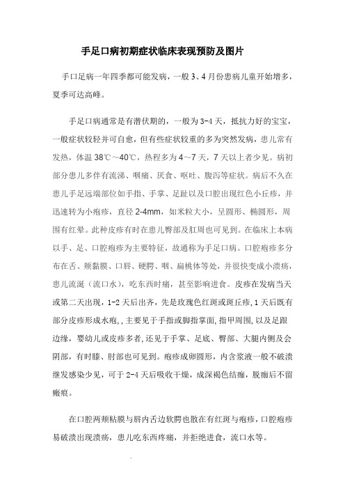 手足口病初期症状及图片