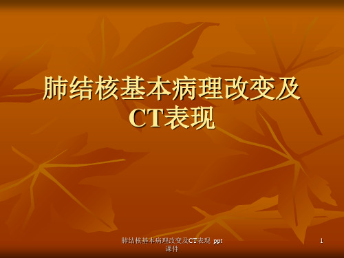 肺结核基本病理改变及CT表现 ppt课件