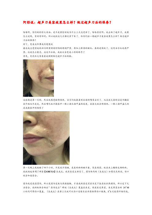 超声刀美容效果怎么样？做过超声刀后的保养？