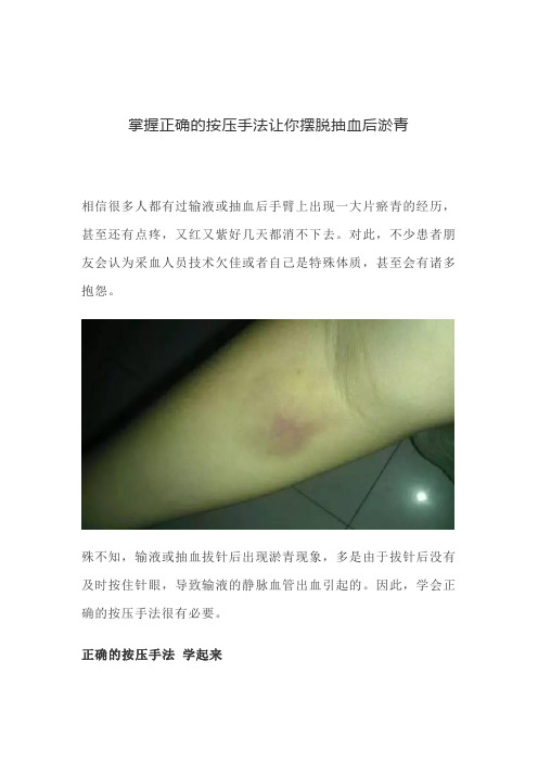 掌握正确的按压手法让你摆脱抽血后淤青