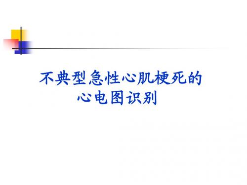 不典型心肌梗死的心电图表现