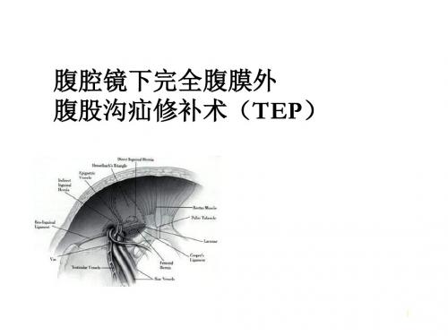 腹腔镜下完全腹膜外腹股沟疝修补术(TEP)
