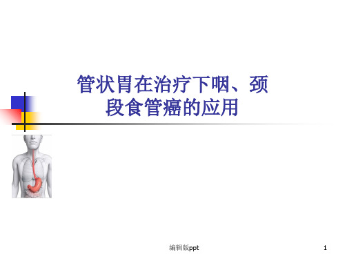 管状胃代食管PPT课件