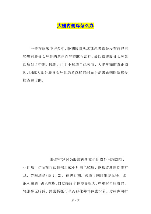 大腿内侧痒怎么办